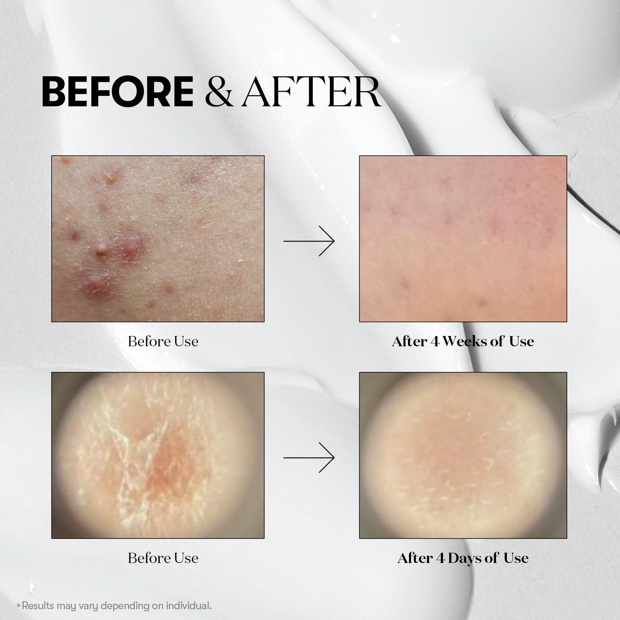 Reedle Shot 100 Micro-needle Face Booster