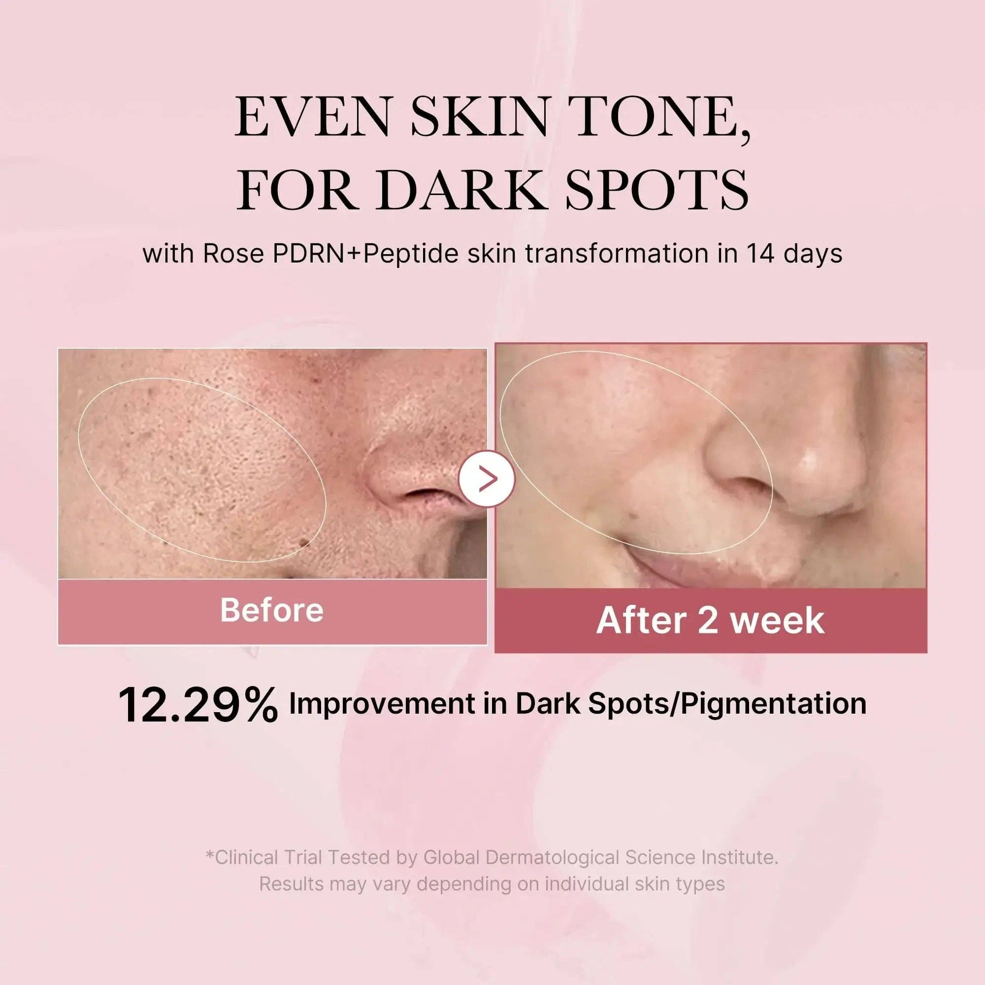 MEDICUBE PDRN Pink Cica Soothing Toner 250ml