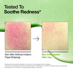 Anua Azelaic Acid 10 Hyaluron Redness Soothing Serum - Image 5